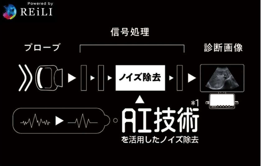 AI-エコー